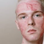 Thriving Through the Chill: Your Ultimate Guide to Skin Health in Winter 2026